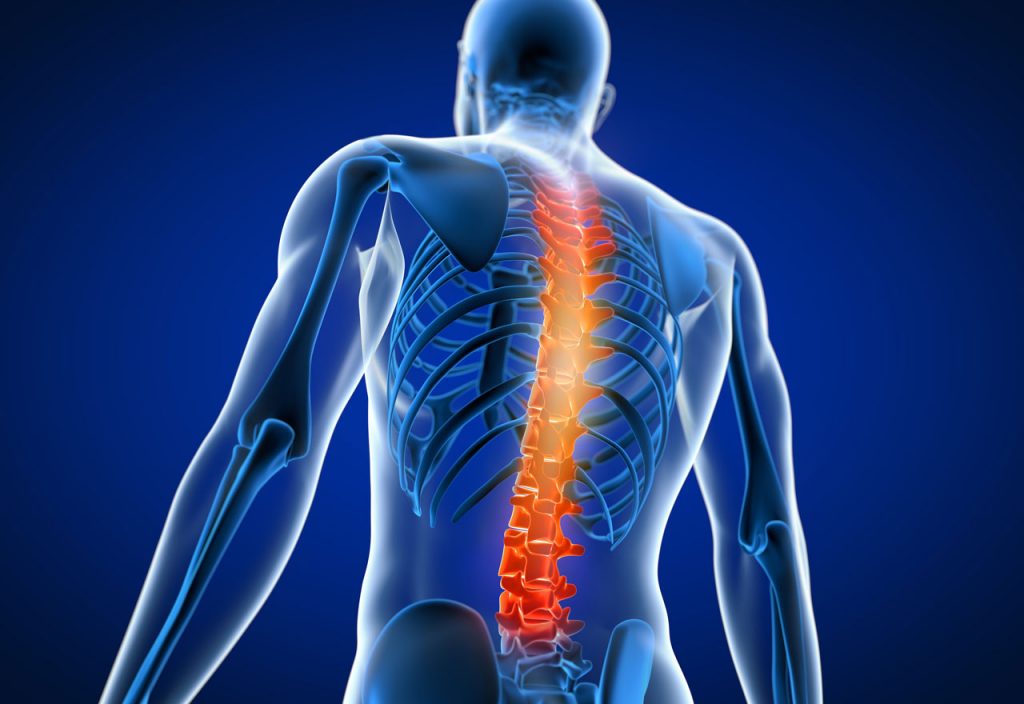 back pain image