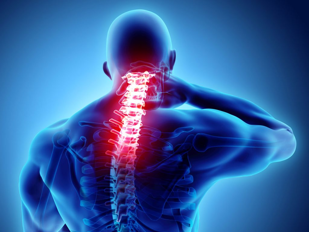 neck pain image